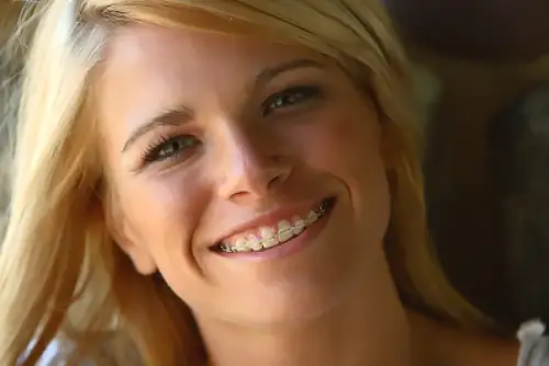 orthodontist in Houston