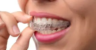 invisalign