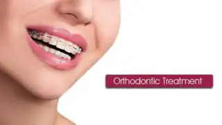 orthodontic