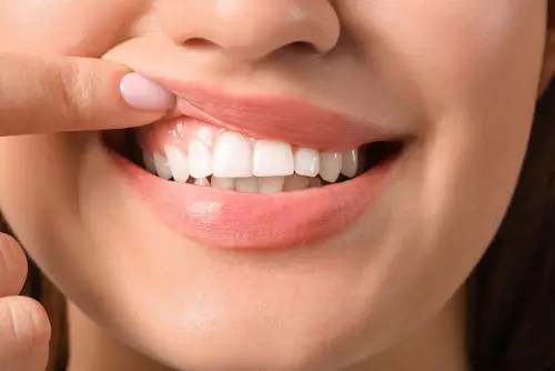 Healthy gums
