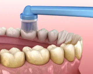 Brushing and Flossing