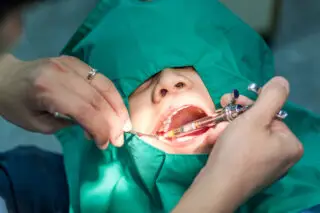 tooth extraction Houston