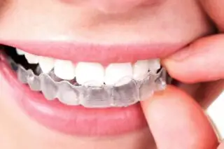 teeth whitening