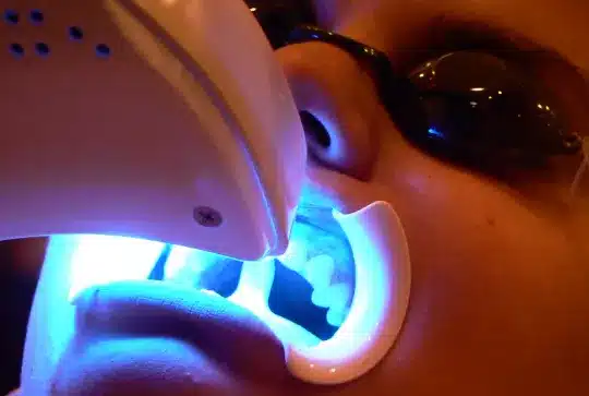 teeth whitening