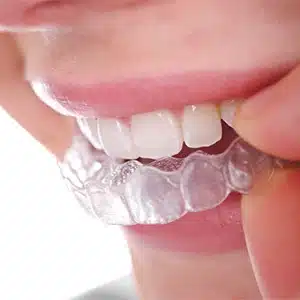 Is Invisalign Painful